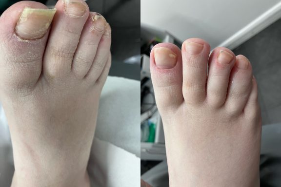 General nail cutting A nice tidy up